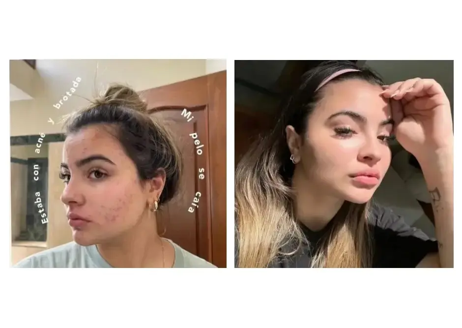 Comparación antes y después de sostener la toma diaria de RENÖVA+